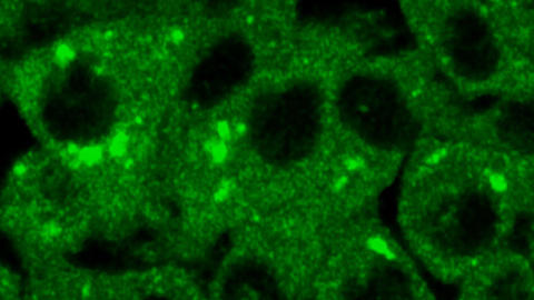 immune cells